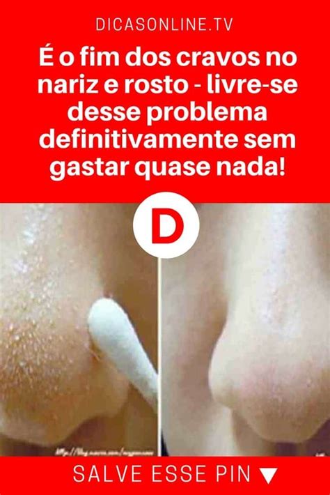 Receita Simples Para Remover Cravos Do Nariz Cravos No Nariz Tira