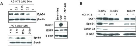 Regulation Of Ephb4 Expression By Egfr Signaling Pathway A Egfr Download Scientific