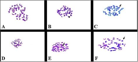 Photomicrographs Of Metaphase Spread From Bone Marrow Cells Of Male