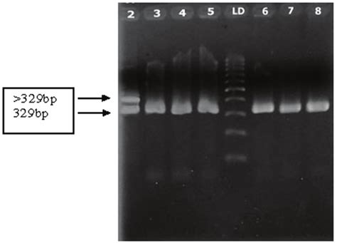 Detection Of Flt Itd Gene Mutation By Pcr Ld Dna Ladder Bp