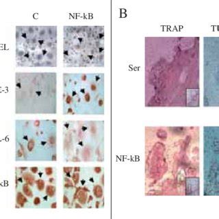 Effect Of Nf Kb Odn Decoy On Osteoclasts A Hocs Were Transiently