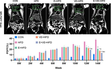 Mr Pdff Proton Density Fat Fraction Scans Showed The Dynamic Changes