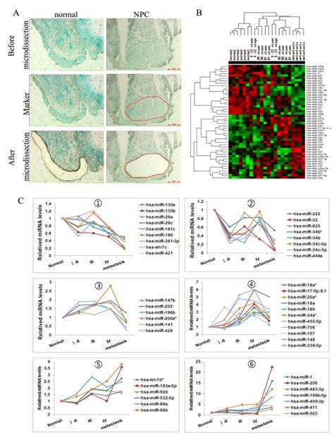 Mirna Expression Profile In The Stepwise Development Of Npc A The