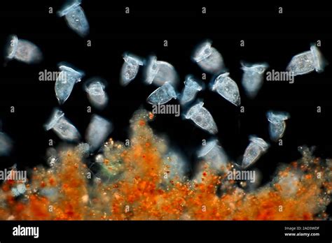 Vorticella Protozoa Differential Interference Contrast DIC Light