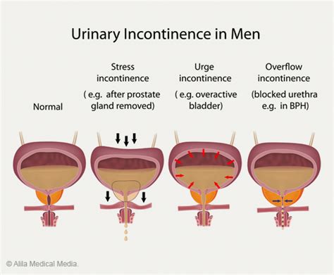 Bladder control supplement