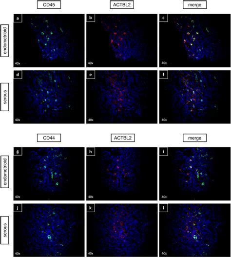 Immunofluorescence Double Staining With Anti Actbl2 Anti Cd45 And Download Scientific Diagram