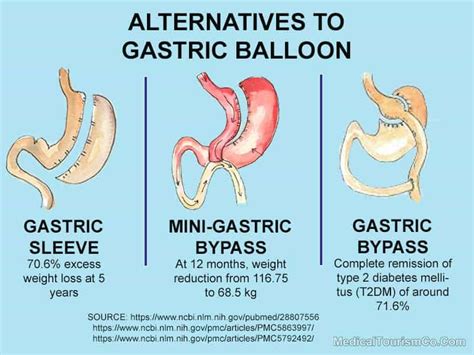 Gastric Balloon In Cancun Mexico