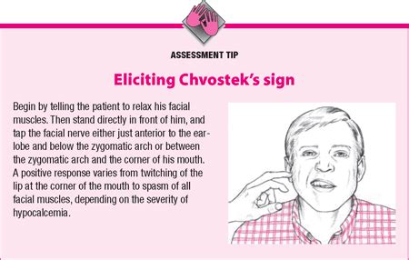 Doctors Gates: Eliciting Chvostek’s sign