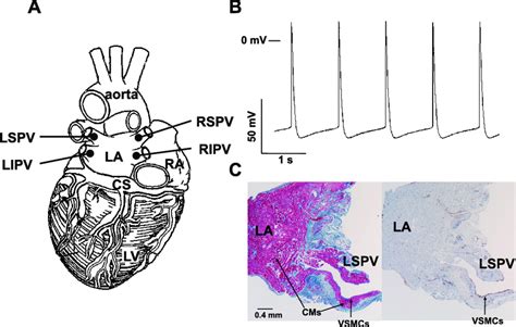 Electrophysiological And Histological Properties Of The Pulmonary Vein Download Scientific