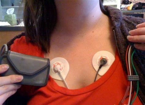 Ekg 24 Hour Holter Monitor