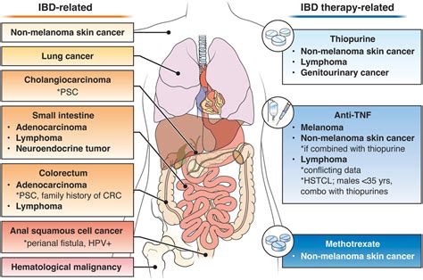 Aga Clinical Practice Update On Management Of Inflammatory Bowel