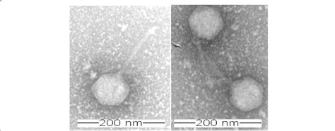 Transmission Electron Micrograph Of Vibrio Phage Vb Vors Pvo Scale