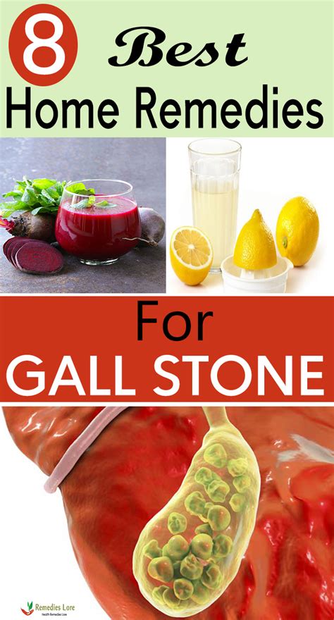 8 Best Home Remedies For Gall Stone Remedies Lore