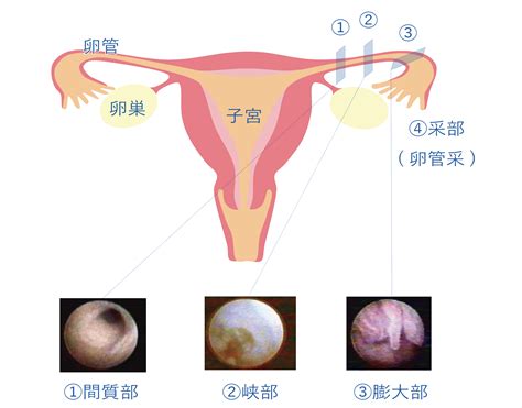 子宮卵管造影検査 【女性医師による不妊治療】保険診療中心のプリュームレディースクリニック