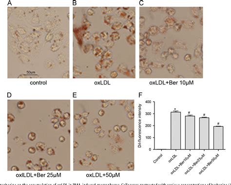 Figure 1 From Berberine Induced Inhibition Of Adipocyte Enhancer