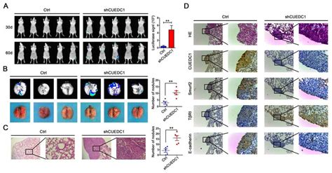 Cuedc1 Inhibited The Metastasis Of Nsclc In Vivo A A Total Of 1×10 6 Download Scientific