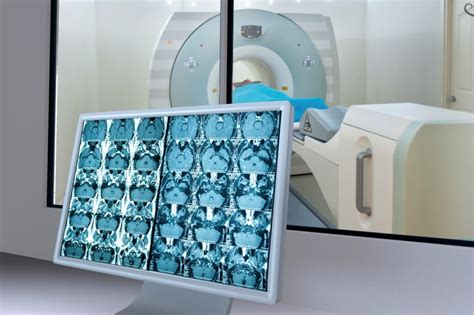 The Parathyroid 4d Ct Scan For Quick Accurate Discovery — Radiology