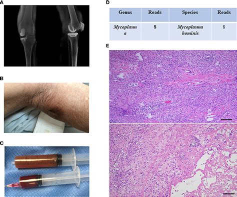 Frontiers Optimization And Standardization Of Mngs Based Procedures