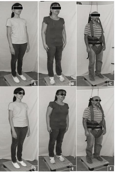 SciELO Brasil Static Postural Balance In Healthy Individuals