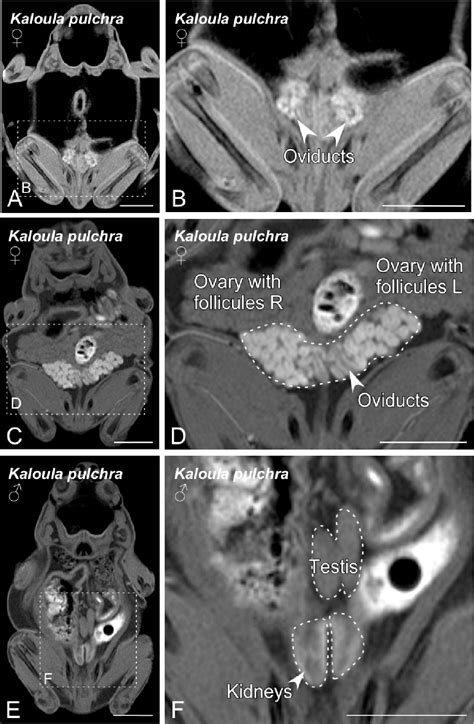 Figure 1 From Sex Determination In Two Species Of Anuran Amphibians By Magnetic Resonance