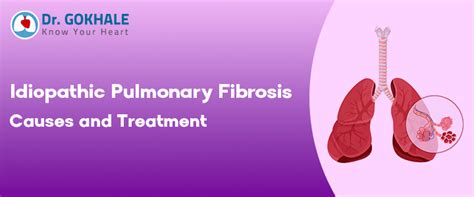 Idiopathic Pulmonary Fibrosis Causes And Treatment Dr Gokhale