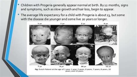 Progeria Syndrome