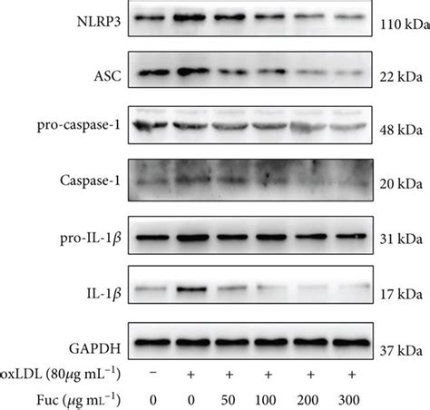 Fucoidan Reduces Lipid Accumulation And Inhibits Nlrp Inflammasome