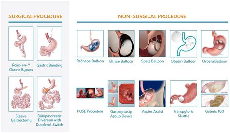 Clinical Practice Guidelines For The Perioperative Nutrition Metabolic