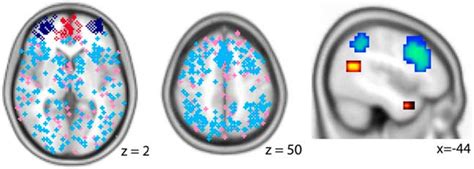 Fifty Years Of Prefrontal Cortex Research Impact On Assessment