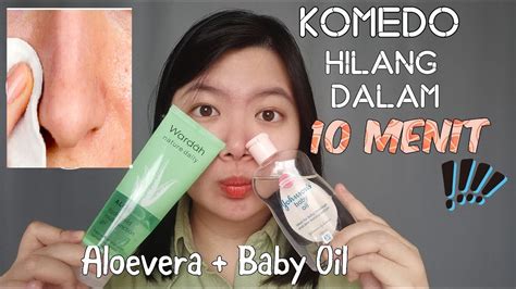 HIDUNG KOMEDOAN BISA JADI MULUS DAN HILANG DALAM 10 MENIT Mudah Dan