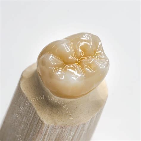 Monolithic Zirconia ROE Dental Laboratory