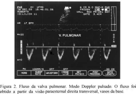 SciELO Brasil Ecocardiografia Modo Doppler Pulsado Em Gatos