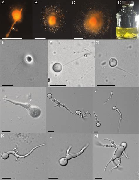 Macroscopic And Microscopic Features Of Liebetanzomyces Polymorphus