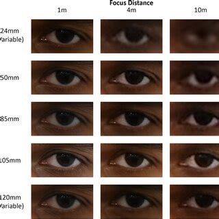 Example palpebral fissure recorded at different FDs and with different... | Download Scientific ...