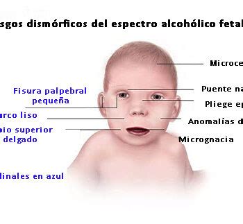 MÁSTER EN PREVENCIÓN Y TRATAMIENTO DE LAS CONDUCTAS ADICTIVAS síndrome