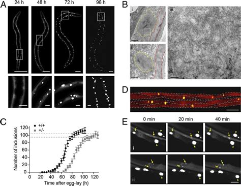 Q40 Yfp Expressed In C Elegans Body Wall Muscle Cells Displays