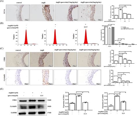 Quercetin Attenuates Angiotensin Iiinduced Proliferation Of Vascular