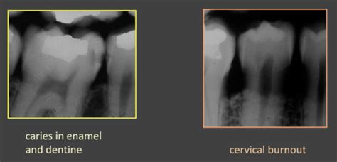 Radiography Day 2 Handout 3d Notes Restoration Maintenance Of Adult