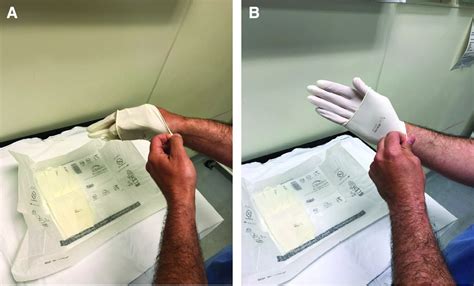 Proper Sterile Gloving Technique For Nonoperating Room Sterile