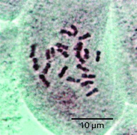 Feulgen Stained Root Tip Metaphase Of Foeniculum Sanguineum Showing 22