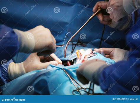 We Work with a Valve. Valve Replacement. Heart Surgery Stock Photo ...