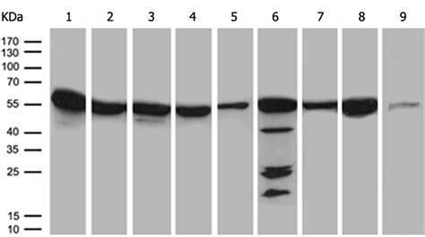 小鼠抗CCT4单克隆抗体 Anti CCT4 mouse monoclonal antibody 生命科学产品与技术服务 生工生物工程 上海