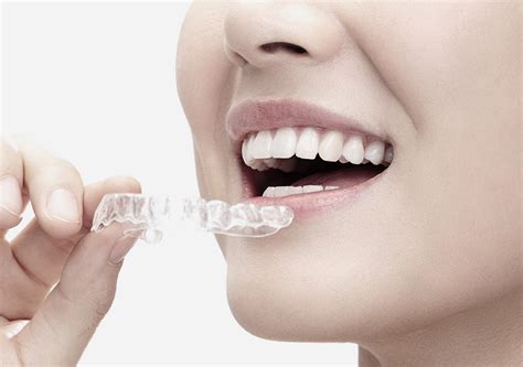 clear aligner dental treatment  korea gangnam gentle dental clinic