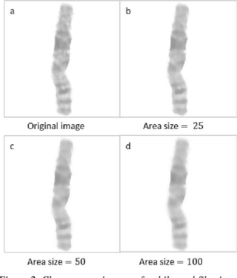 Figure 2 From Prediction Of Centromere Location In Human Chromosome Using Convolutional Neural