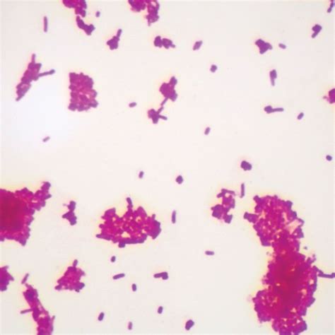 √100以上 e coli morphology gram stain 283207-E.coli gram stain morphology ...