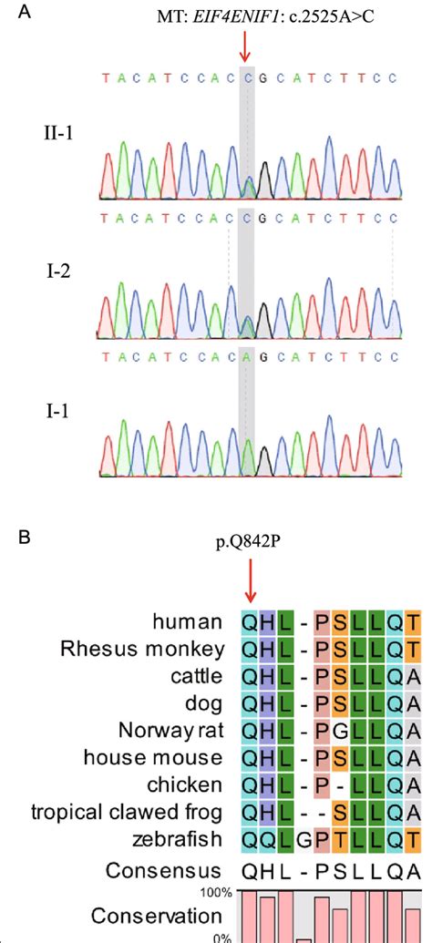 Analysis Of The Eif Enif Variant A Sanger Sequencing Validation Of