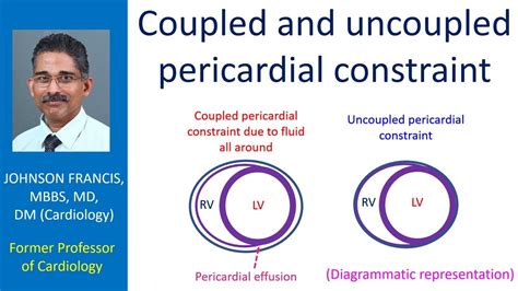 Coupled And Uncoupled Pericardial Constraint Back To Basics YouTube