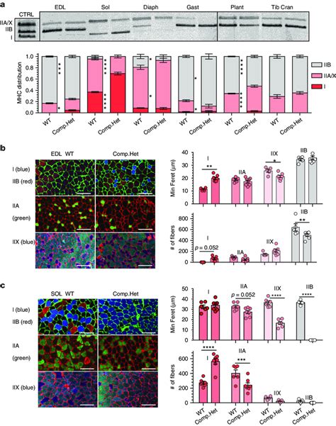 Myosin Heavy Chain MHC Isoform Distribution And CSA Analysis A MHC