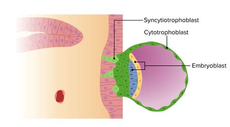O Que É Trofoblasto - Desarrollo del Embrioblasto y Trofoblasto | Concise Medical Knowledge