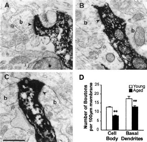 Characterization Of Spontaneous Epscs And Ipscs In Layer V Pyramidal